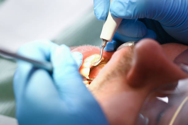 Best Tooth Infection Emergency Dentist  in Montezuma, GA